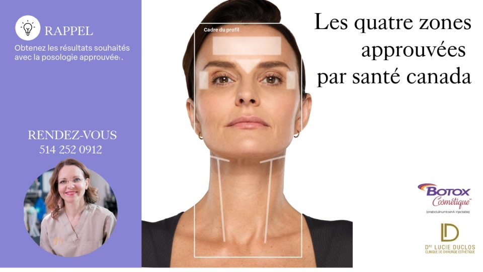 les 4 zones approuvées par santé canada